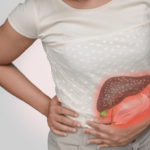 Chronic Liver Disease