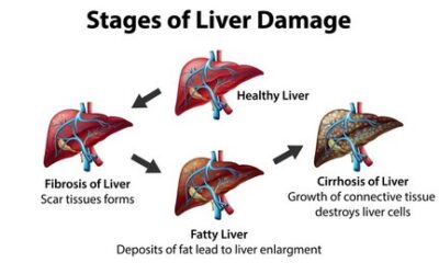 Animation illustrating the liver’s regenerative process showing hepatocyte proliferation and liver tissue repair to restore liver function.