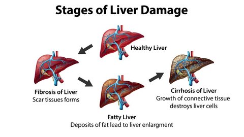 Animation illustrating the liver’s regenerative process showing hepatocyte proliferation and liver tissue repair to restore liver function.